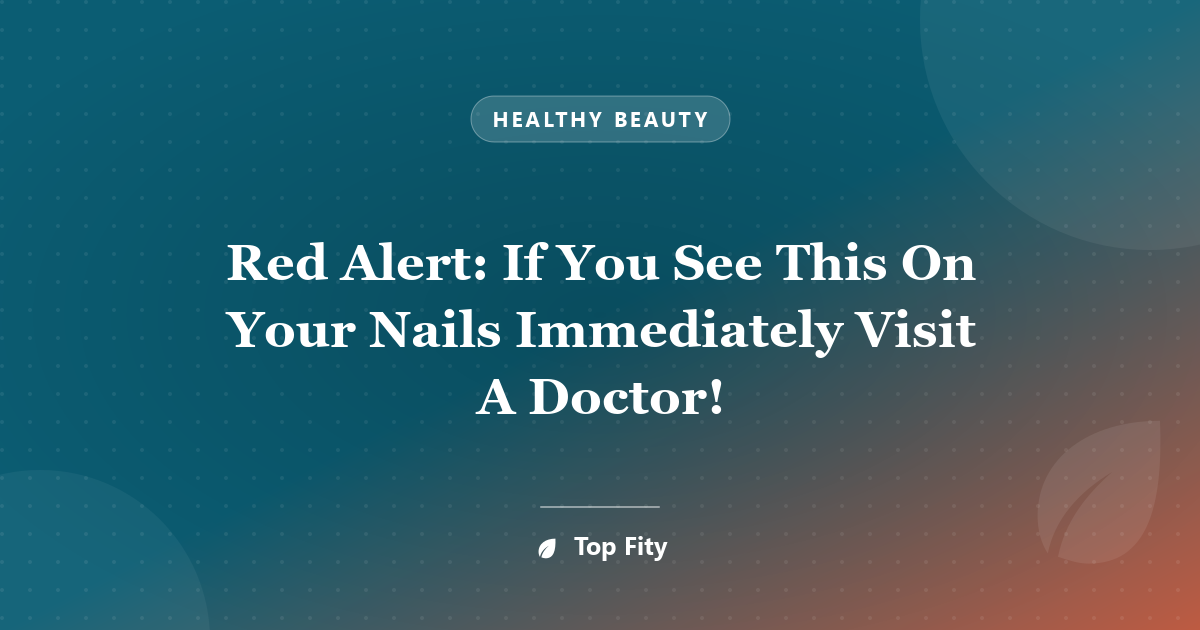 Red Alert: If You See This On Your Nails Immediately Visit A Doctor!