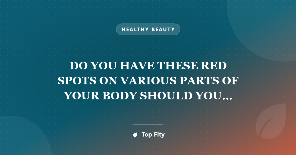 DO YOU HAVE THESE RED SPOTS ON VARIOUS PARTS OF YOUR BODY SHOULD YOU WORRY – WHAT SHOULD YOU DO