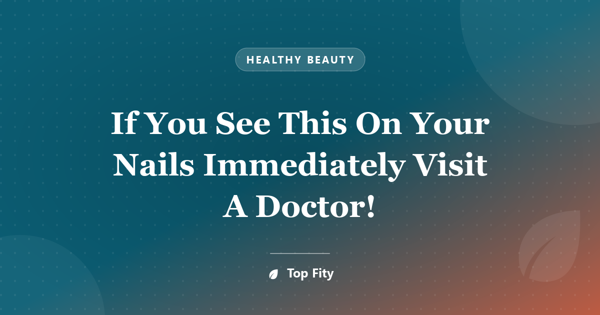 If You See This On Your Nails Immediately Visit A Doctor!