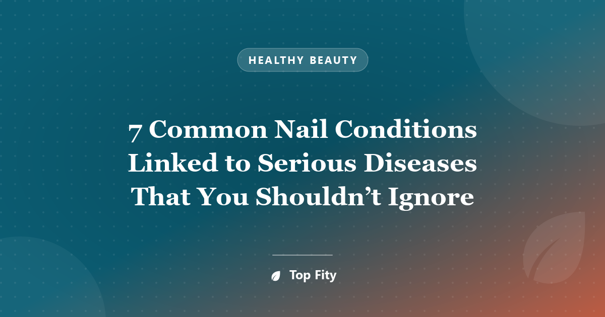 7 Common Nail Conditions Linked to Serious Diseases That You Shouldn’t Ignore