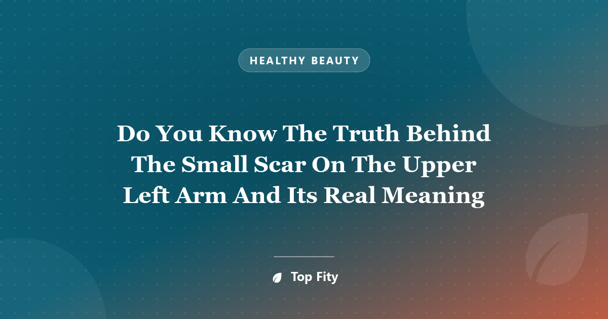 Do You Know The Truth Behind The Small Scar On The Upper Left Arm And Its Real Meaning