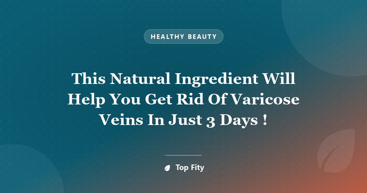 This Natural Ingredient Will Help You Get Rid Of Varicose Veins In Just 3 Days !